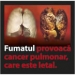 Smoking provokes you lung cancer.